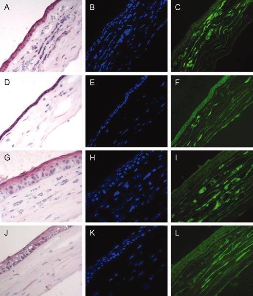 FIGURE 7. Representative mouse cornea sections. Wild-type C57BL/6 or TLR2, TLR4, or TLR2/4 deficient mice were injected with Onchocerca volvulus as described. Hematoxylin stain shows tissue morphology (left panels), DAPI nuclear stain reflects overall cellularity (middle panels, blue), and immunohistochemistry staining with anti-F4/80 Ab shows macrophages (right panels, green). C57BL/6 (A–C), TLR2−/− (D–F), TLR4−/− (G–I), and TLR2/4−/− (J–L) mice are represented.