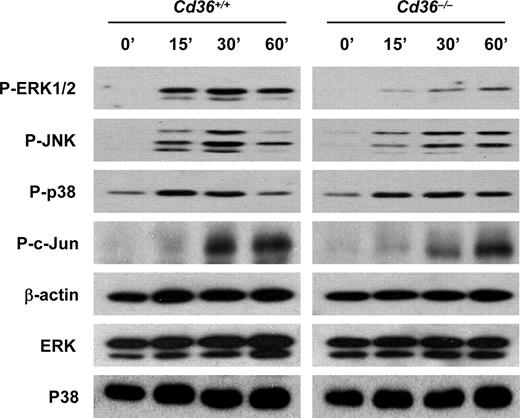 FIGURE 2. Cd36−/− Mφ have impaired phosphorylation of MAPK pathways in response to pfGPI stimulation. Cd36+/+ and Cd36−/− Mφ were analyzed either with or without stimulation with HPLC-purified pfGPI (80 nM) for 0–60 min as indicated. Cell lysates were resolved by 12% SDS-PAGE and immunoblotted with phospho-ERK1/2, phospho-JNK, phospho-p38, and phospho-c-Jun Abs, respectively. Unphosphorylated total ERK, p38, and β-actin were used as loading controls. Data for each time for ERK1/2, JNK, p38, and c-Jun phosphorylation were derived from the same experiment, run on the same gel, and subjected to the same exposure time. Data are representative of results from three independent experiments.