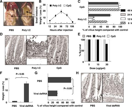 FIGURE 1. Induction of acute small intestinal injury by poly(I:C) or viral dsRNA. A–E, B6 mice were injected with poly(I:C) or CpG (30 μg/g wt). A, A representative macroscopic photograph of small intestine from B6 mice at 12 h postinjection of poly(I:C) (n = 3). B, Weight loss (referring to the weight at 0 h) was evaluated at various time points postinjection (n = 5). C, Morphometric analysis of villous height of small intestine from poly I:C-, CpG-, and PBS-treated mice (n = 3 for each group) at various time points. ∗, p < 0.05. D, Representative photographs for H&E-stained paraffin-embedded sections from B6 mice (n = 3) at 12 h postinjection (original magnification, ×200). E, Mice survival (n = 10) was evaluated at 36 h postinjection. F–H, B6 mice were injected with purified viral dsRNA (5 μg/g wt). F, Weight loss (referring to the weight at 0 h) at 36 h postinjection (n = 3). G, Morphometric analysis of villous height of small intestine from viral dsRNA or PBS-treated mice (n = 3 for each group) at 12 h postinjection. H, Representative photographs for H&E-stained paraffin-embedded sections from B6 mice (n = 3) at 12 h postinjection (original magnification, ×200). Values in B, C, E, F, and G are shown in means ± SEM from three independent experiments.