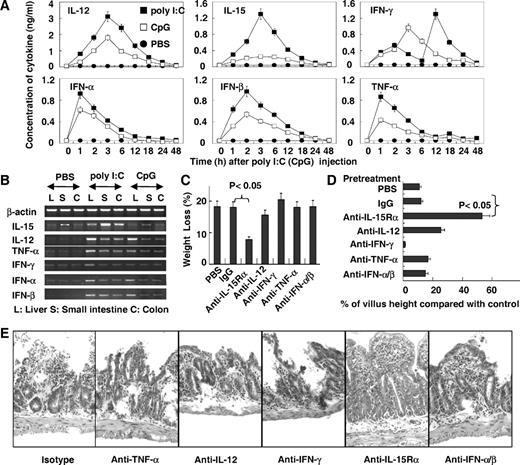 FIGURE 2. Role of IL-15 in small intestinal injury caused by poly(I:C). A, Serum samples were collected at various time points post-poly(I:C) or -CpG (30 μg/g wt) injection for measuring TNF-α, IFN-γ, IL-15, IFN-α, IFN-β, and IL-12, respectively. B, The mRNA levels of cytokines was detected by RT-PCR in the liver, small intestine (SI), and colon of B6 mice at 1 h postinjection of poly(I:C). C–E, B6 mice (n = 3) were pretreated with the indicated neutralizing Ab 12 h before poly(I:C) injection. C, Thirty-six hours following poly(I:C) injection, the weight of mice was measured, and the percentage of weight loss (referring to the weight at 0 h) is shown. D and E, Twelve hours following poly(I:C) injection morphometric analysis of villous height (D) and representative photographs for H&E-stained paraffin-embedded sections (E) (original magnification, ×200) are shown. Values in A, C, and D are shown in means ± SEM from three independent experiments.