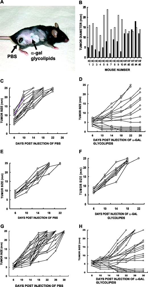 FIGURE 4. Treatment of cutaneous B16 melanoma by intratumoral injection of α-gal glycolipids. A, Tumor size 10 days after intratumoral injection of α-gal glycolipids (front tumor) or PBS (back tumor). Treated tumors had an initial diameter of ∼5 mm. Shown is one representative mouse of 10 mice. B, Comparison of tumor size 10 days following injection of 1 mg of α-gal glycolipids (▪) or PBS (□) of tumors growing in the same mouse (n = 10). Tumors injected with α-gal glycolipids in KO mice are much smaller than the PBS-treated tumors in each mouse. No significant differences are observed between the two treatments in WT mice (n = 5). C–F, B16 tumor growth in mice after injections of α-gal glycolipids or PBS. C, KO mice injected twice with PBS (n = 15). D, KO mice injected twice with 1.0 mg of α-gal glycolipids (n = 15). E, WT mice injected twice with PBS (n = 8). F, WT mice injected twice with 1.0 mg of α-gal glycolipids (n = 8). G, B16/OVA tumor growth in KO mice after two injections of PBS (n = 22). H, Growth of B16/OVA in KO mice after two injections of 1.0 mg of α-gal glycolipids (n = 22).