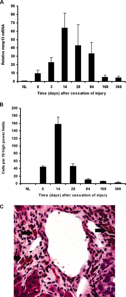 FIGURE 1. mmp13 transcript is up-regulated during resolution of liver fibrosis in rats and correlates with the relative abundance of SAMs. A, mmp13 mRNA expression (relative to 18S RNA and normal liver) during spontaneous resolution of advanced liver fibrosis after 12-wk CCl4 injury (n = 4 per time point). Transcript was detected at low levels in normal untreated liver. There was a 10-fold increase in transcript level at peak fibrosis. However, this increased 70-fold at day 14 of resolution. mmp13 transcript levels remained markedly elevated for a protracted period during the resolution of fibrosis in this rat model of remodeling. B, SAM numbers during resolution in 12-wk CCl4 rat liver fibrosis. SAM numbers (defined as ceroid-containing cells with macrophage morphology within or apposed to scar) were increased 40-fold compared with normal livers (NL). However, during the early resolution phase, the number increased further and remained markedly elevated 28 days after injury. Even 366 days after cessation of CCl4 injury, a small number of these cells remained apposed to the residual fibrotic bands. Note the correlation between SAM numbers and whole liver mmp13 mRNA during spontaneous resolution. C, Macrophages were identified in H&E-stained sections as described above, and examples are shown (arrows) associated with an area of hepatic scarring at day 14 during the recovery phase.