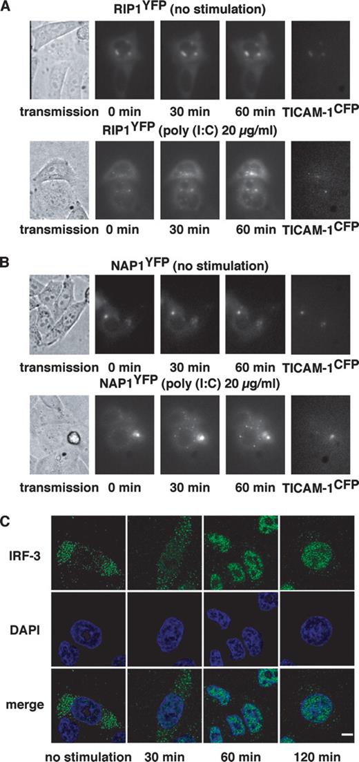 FIGURE 4. Subcellular localization of RIP1, NAP1, and IRF-3. A and B, RIP1 and NAP1 accumulate in the speckle-like structures in response to poly(I:C). HeLa cells coexpressing RIP1YFP (A) or NAP1YFP (B) with TICAM-1CFP were placed on a time-lapse microscope and imaged every 10 min. Cells were stimulated with poly(I:C) (20 μg/ml) for up to 60 min (lower panels) or left unstimulated (upper panels). Fluorescent images of YFP at the indicated time periods are shown. CFP images indicate the expression level of TICAM-1. C, Nuclear translocation of IRF-3 induced by poly(I:C) stimulation. HeLa cells were seeded onto cover glass and stimulated with poly(I:C) (40 μg/ml) for up to 120 min. At the indicated periods, cells were fixed, stained with anti-IRF-3 mAb and Alexa Fluor 568-conjugated secondary Ab, and subjected to confocal analyses. Green, IRF-3; blue, nuclei with DAPI; bar, 10 μm.