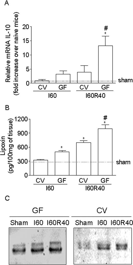 FIGURE 2. Levels of IL-10 mRNA, LXA4 and ANXA-1 are enhanced in the intestine of conventional and germfree mice. Germfree (GF) or conventional (CV) mice were submitted to sham (Sh) operation, 60 min of ischemia (I), or 60 min of ischemia followed by 40 min of reperfusion (I60R40). Expression of IL-10 was measured by real-time RT-PCR, LXA4 was evaluated by ELISA and ANXA-1 by Western blot analysis as described in Materials and Methods. In A and B, data are mean ± SEM of measurements on five mice per group and are from one of two representative experiments ∗, p < 0.01 when compared with sham-operated mice; #, p < 0.01 when compared with mice submitted to reperfusion injury. In C, a pool of four animals in each condition is shown. Experiments were repeated twice.