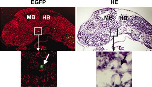 FIGURE 5. Pharyngeal eGFP+ cells in rag1-egfp-transgenic medaka at embryonic stage 29 (3 dpf). eGFP expression (in green, left) and H&E staining (right) of the embryos at stage 29 (3 dpf) are shown. eGFP+ cells were detected at the region dorsal to the second and third pharyngeal pouches and ventral to the midbrain (MB)-hindbrain (HB) boundary. Red signals in confocal microscopy images (left) represent background transmission.