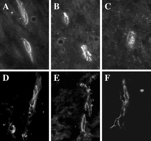FIGURE 5. Expression patterns of TJ proteins in spinal cord sections from a HAM/TSP patient. A–C, Detection of ZO-1 by immunofluorescence on cryostat sections from spinal cord of a HAM/TSP patient (B and C) or uninfected patient (A). A more diffused pattern is observed in C when compared with unaffected areas (B), or to the pattern observed on uninfected patient (A). Magnification, ×1000. D–F, Detection of occludin by immunofluorescence on cryostated sections from spinal cords of a HAM/TSP patient (D–F). In all areas, the staining was continuous.