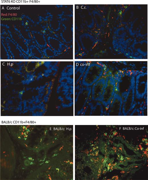 FIGURE 4. Helminth-induced increase in macrophage numbers in colonic LP of mice is mediated through a STAT6-dependent mechanism. Uninfected STAT6 KO (A) mice and STAT6 KO mice infected with C. rodentium (C.r.) (B), H. polygyrus (H.p) (C), or both (co-inf, coinfected) (D) were sacrificed 2 wk after bacterial infection. BALB/c mice infected with H. polygyrus (E) and coinfected (F) were included as controls. Magnification, ×400. Five-micrometer sections of frozen colonic tissue (in OCT) were cut, fixed, and stained for CD11b (green) and F4/80 (red) as described in the Fig. 1 legend.