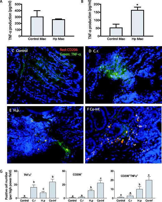 FIGURE 7. Helminth-induced, alternatively activated macrophages (Mac) (CD206+) produce TNF-α in response to C. rodentium (C.r.) exposure. A and B, Macrophages were isolated from MLN of uninfected (Control) and H. polygyrus (Hp)-infected mice, incubated overnight in complete DMEM, and then exposed to C. rodentium for 1 h. Two (A) and 6 h (B) after infection, culture supernatants were collected. TNF-α production of MLN macrophages was measured by ELISA. The data shown are the mean + SE of triplicate cultures. ∗, p < 0.05 for a comparison of cells isolated from uninfected mice vs cells obtained from helminth-infected mice. C–F, Colon tissues were prepared as in Fig. 1. The tissues were stained with anti-CD206 Ab (red) and anti-TNF-α (green). The immunofluorescence microscopic analysis showed that C. rodentium infection induced TNF-α production by cells other than CD206+ cells (D). H. polygyrus infection results in the induction of TNF-α producing cells that express the alternatively activated phenotype (CD206+) (E). Helminth and C. rodentium coinfection (F) resulted in a marked increase in alternatively activated macrophages that produce TNF-α in colon tissues. G, The mean number of TNF-α+, CD206+, and CD206+TNF-α+ cells detected in each high power field (×200) by counting five fields from each sample (three mice from each group were counted). Different letters represent significant differences (p < 0.05). Co-inf, coinfected.