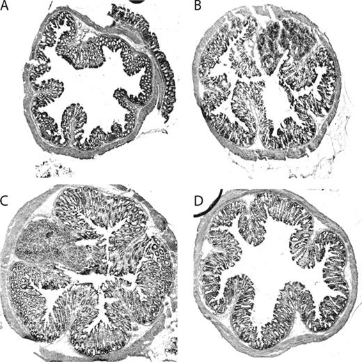 FIGURE 8. Helminth coinfection results in increased colonic inflammation due to impaired ability to control bacterial infection. Colon tissue was prepared from uninfected (A), C. rodentium-infected (B), helminth- and C. rodentium-coinfected (C), and coinfected and antibiotic-treated mice (D). Five-micrometer sections of frozen colonic tissue (in OCT) were cut, fixed, and stained with H&E. The figures shown are representative histology of the distal colon 2 wk after C. rodentium infection.