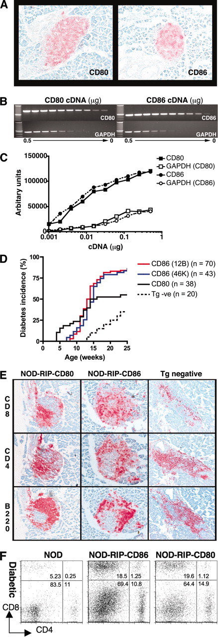 FIGURE 1. Accelerated diabetes in NOD-RIP-CD80 and NOD-RIP-CD86 mice. A, Expression of CD80 or CD86 was confirmed at 6-wk old by immunohistochemistry on frozen sections. Sections shown are representative of three individual mice per strain. B, Comparative expression of CD80 and CD86 levels was tested using PCR amplification of 2-fold dilutions of cDNA (0.5–9.8 × 10−4 μg) extracted from islets isolated from eight mice per strain. GAPDH was used as a housekeeping control. C, Densitometry confirmed similar expression of CD80 and CD86 expression. D, Male and female NOD-RIP-CD80, NOD-RIP-CD86 (12B and 46K), and transgene-negative mice were monitored weekly for diabetes onset by testing for glycosuria and confirmed by testing blood glucose levels (>14 mM/L). Log-rank tests showed no statistically significant difference between 12B and 46K mice (p = 0.28) but significant differences were found between NOD-RIP-CD80 and NOD-RIP-CD86 (12B and 46K) mice (p = 0.002). E, Islet infiltrates from diabetic NOD-RIP-CD80, NOD-RIP-CD86, and transgene (Tg) negative mice were tested for the presence of CD8, CD4, and B cells by immunohistochemistry on frozen sections. F, Islet-infiltrating cells isolated from diabetic NOD, NOD-RIP-CD80, and NOD-RIP-CD86 islets were stained for CD8 and CD4. Cells were extracted from islets pooled from three mice per group.