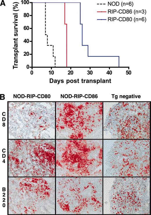 FIGURE 2. Diabetes recurred more slowly in diabetic NOD-RIP-CD80 mice. A, Transplant survival was monitored in diabetic NOD, NOD-RIP-CD80, and NOD-RIP-CD86 mice in which islets from 6-wk-old NOD mice were transplanted under the kidney capsule and rendered euglycemic after 48 h. The difference in time of development of recurrent diabetes was statistically significant (p < 0.05). B, Cellular phenotypes infiltrating transplanted islets in diabetic NOD (Tg negative (−ve)), NOD-RIP-CD80, and NOD-RIP-CD86 were examined by immunohistochemistry on frozen sections.