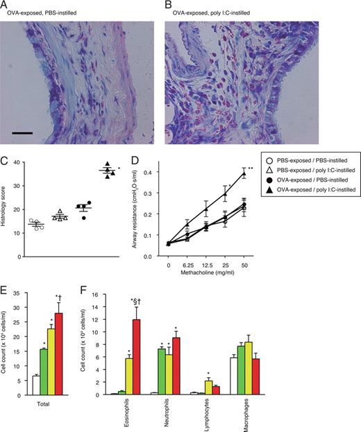 FIGURE 1. Poly I:C-induced enhancement of allergic airway inflammation and bronchial hyperresponsiveness in BN rats. PBS or poly I:C was instilled intratracheally 16 h after exposure to either PBS or OVA in sensitized rats. Eosinophil infiltration in the bronchial wall of OVA-exposed/PBS-instilled (A) and OVA-exposed/poly I:C-instilled animals (B). Tissue sections were stained with Giemsa. Bar, 100 μm. C, Semiquantitative scoring of airway histology (eosinophil accumulation in the peribronchial area). Mean values ± SEM (n = 4 each); ∗, p < 0.001 vs OVA-exposed/PBS-instilled animals. D, Concentration-response curves of airway resistance to inhaled methacholine. Mean values ± SEM (n = 9 − 13); ∗, p < 0.01, ∗∗, p < 0.001 vs OVA-exposed/PBS-instilled animals. (E) Total and (F) differential cell counts of leukocytes in BAL fluid. PBS-exposed/PBS-instilled (white column; n = 8), PBS-exposed/poly I:C-instilled (green column; n = 4), OVA-exposed/PBS-instilled (yellow column; n = 6), OVA-exposed/poly I:C-instilled (red column; n = 5) animals; ∗, p < 0.001 vs PBS-exposed/PBS-instilled group; §, p < 0.001 vs OVA-exposed/PBS-instilled animals; †, p < 0.001 vs PBS-exposed/poly I:C-instilled group.