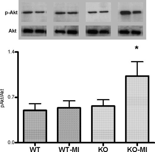 FIGURE 4. Activation of Akt in the noninfarcted area. The ratio of the protein content of pAkt:Akt in the noninfarcted area was determined using Western blot analyses (n = 6 per group). Representative blots of two animals per group were shown above the specific column. Data are expressed as mean ± SEM. ∗, p < 0.05 vs WT, WT-MI, and KO.