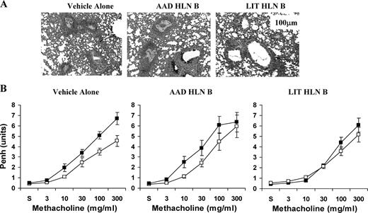 FIGURE 2. Adoptive transfer of LIT HLN B cells into OVA-sensitized mice before OVA aerosol challenge attenuated lung inflammation (A) and methacholine sensitivity (B) after 7 days of OVA aerosol exposures. A, Qualitative histological evaluation demonstrated that adoptive transfer of LIT HLN B cells reduced lung inflammation with subsequent OVA aerosol exposure. Representative histopathology sections demonstrated decreased peribronchial and perivascular inflammation in LIT HLN B cell transfer mice compared with vehicle and AAD HLN B cell transfer mice. Images are at ×20 magnification; the bar in each plate represents 100 microns. B, Adoptive transfer of LIT HLN B cells prevented the development of increased methacholine responsiveness following OVA aerosol exposures. Methacholine sensitivity was compared in sensitized animals before (open symbols) and after 3 days of OVA aerosol exposures (filled symbols). Baseline, preaerosol sensitivity to methacholine did not differ in control mice (left; n = 11), mice receiving AAD HLN B cells (middle; n = 8), and mice receiving LIT HLN B cells (right; n = 13). Both control and AAD HLN B cell-recipient animals developed increased sensitivity to methacholine after OVA aerosols, as demonstrated by leftward shifts in the Penh dose-response relationships. In contrast, transfer of LIT HLN B cells prevented the development of increased methacholine sensitivity.