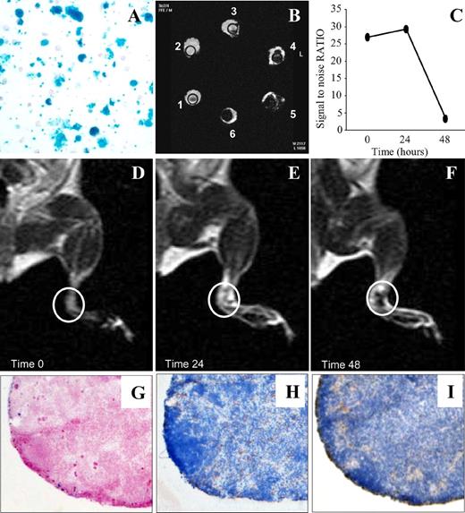 FIGURE 1. Effective tracking of DCs in vitro and in vivo by MRI. DCs were labeled with SPIO particles, as detectable by Prussian blue staining/nuclear fast red counterstaining of cytospins (SPIO 640 μg/ml) (A) or by MRI of tubes containing water (no. 1) or pellets of DCs incubated with increasing concentrations of SPIO (in μg/ml: no. 2, 0; no. 3, 80; no. 4, 160; no. 5, 320; no. 6, 640): the amount of internalized iron correlates with the intensity of the reduction of the signal (B). C–F, SPIO+ DC were injected into the footpads. MRI analysis of draining popliteal lymph nodes was conducted immediately after (time 0, D) and 24 and 48 h after injection (E and F, respectively). C, Reduction of signal (signal-to-noise ratio, y-axis) associated with iron particles in the popliteal lymph node at different times after injection (hours, x-axis). G–I, Immunohistochemical staining of the draining popliteal lymph nodes 48 h after injection: at this time point iron particles (G), CD11c+ cells (H), and CD45.2+ cells (I) were clearly detectable in the subcapsular zone. Results are from representative routine experiments.