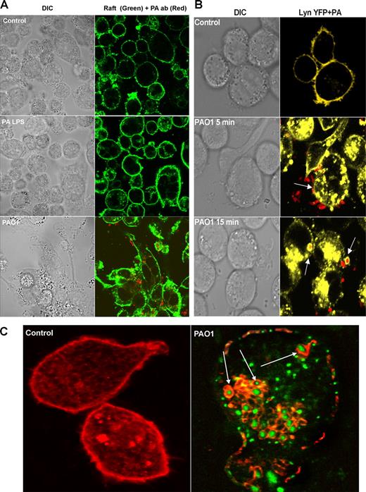 FIGURE 1. Involvement of rafts and Lyn in PA infection. A, Bacterial infection induced rafts reorganization. MHS cells were stained with raft marker (FITC-labeled cholera toxin B chain (CTB; green) and infected with PAO1 (detected by rabbit polyclonal Abs, rhodamine). Arrow shows raft aggregation at bacterial contact sites. PA LPS (serotype 10, 100 μM; Sigma-Aldrich). B, Lyn was found around the PA in the membrane. Primary rat AM transiently transfected with Lyn-YFP and infected for 5 and 15 min with PAO1 identified by Abs compared with the control (PA within phagocytic cup, arrows). C, Lyn stained with anti-Lyn Abs (red) was localized in vesicles containing the phagocytosed GFP-PAO1 (green, 30 min postinfection).