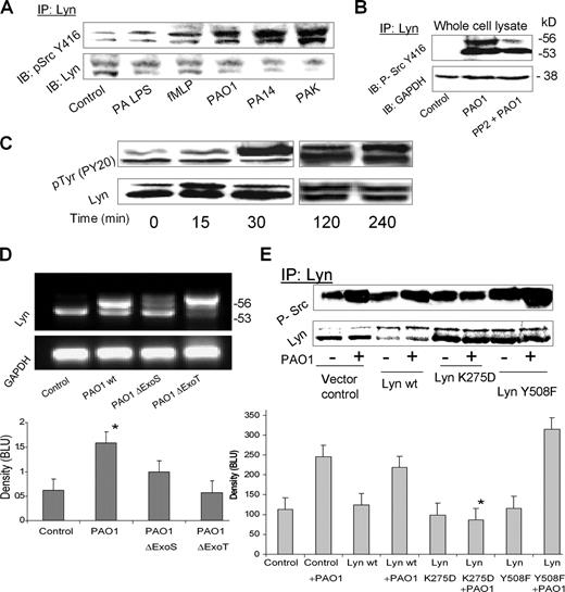 FIGURE 2. PA infection of AM induces Lyn activity. A, Phosphorylation of Lyn at active tyrosine site. Lyn activation was analyzed by immunoprecipitation with Lyn Ab (Santa Cruz Biotechnology), followed by immunoblotting with phospho-Src (Tyr416) Ab (Cell Signaling Technology). MHS cells were stimulated for 30 min with purified PA LPS (serotype 10, 100 ng/ml), fMLP (5 μM), PAO1, PA14, and PAK (wt strains). B, Blocking of Lyn activation by PP2. MHS cells were treated with PP2 at 5 nM for 30 before PAO1 infection, and the samples were assessed, as above. C, Time course infection with PAO1 in rat AM. Phosphotyrosine immunoblot shows an increase in Lyn phosphorylation by 0–240 min. D, Increase in mRNA levels of Lyn detected by RT-PCR. Total RNA was isolated from MHS cells infected with PAO1. The PCR product was resolved on 1% agarose gel, and the bands were quantified by densitometry software. Bottom panel, Shows the intensities of the Lyn mRNA (p < 0.05, 95% CI). E, Reduction of Lyn phosphorylation by inactivating the kinase region. MHS cells were transfected with wt, DN, and constitutively active Lyn, and infected with PAO for 30 min. Lyn phosphorylation was determined by immunoprecipitation with Lyn Abs and probed with phospho-Src Abs. Bottom panel, Shows the intensities of phosphorylation (∗, p < 0.05).