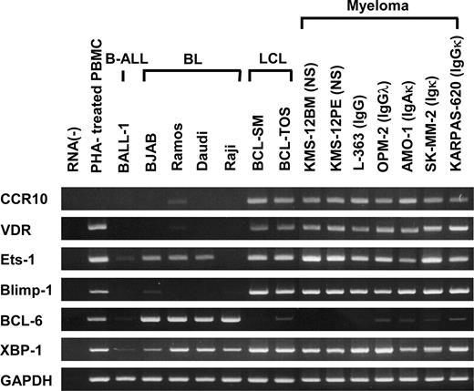 FIGURE 5. RT-PCR analysis of human B cell lines. Total RNA was isolated from the indicated cell lines as follows: BALL-1 (a human B acute lymphoblastic leukemia cell line), BJAB and Ramos (EBV-negative Burkitt’s lymphoma cell lines), Daudi and Raji (EBV-positive Burkitt’s lymphoma cell lines), BCL-SM and BCL-TOS (EBV-transformed LCLs), KMS-12BM, KMS-12PE, L-363, OPM-2, AMO-1, SK-MM-2, and KARPAS-620 (myeloma cell lines). The isotype of secretory Ig is indicated in parenthesis. NS, nonsecretor. Semiquantitative RT-PCR was performed for CCR10, VDR, Ets-1, Blimp-1, BCL-6, XBP-1, and GAPDH. The representative results from three separate experiments are shown.