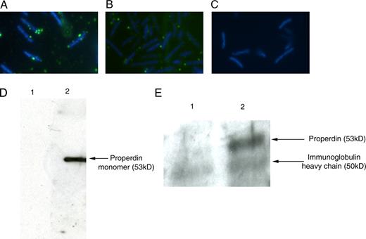 FIGURE 5. Properdin associates with E. coli DH5α. A, After incubation of E. coli DH5α with human serum (determined at 27 μg/ml properdin), properdin was detected using a monoclonal anti-human properdin Ab and FITC-coupled anti-mouse Fab Igs. B, After incubation of E. coli DH5α with purified properdin (25 μg/ml stock), bound properdin was detected as above. C, Negative control (addition of the secondary Ab only). Different sera were used and the amount of exogenous properdin was adjusted to the respective serum concentration. This is a representative figure of three such experiments. D, Aliquots of the purified properdin preparation were separated by SDS-PAGE and analyzed for possible C3 content using mouse anti-human C3 (ab11871; Abcam) (strip 1). Strip 2 of the same transfer was developed with mouse anti-human properdin Ab (HYB 039-06; AntibodyShop) and shows the expected 53-kDa band for monomeric properdin. E, Immunoprecipitation of properdin bound to E. coli DH5α (lane 2) and control (lane 1) using monoclonal anti-human properdin Ab. Transferred lysates were developed with polyclonal goat anti-human properdin Ab. The 53-kDa band for properdin is indicated. The secondary Ab (rabbit anti-goat Ig, HRP conjugated) reacts with Igs contained in both immunoprecipitates. The H chain of Ig is indicated.