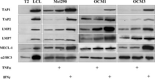 FIGURE 1. IFN-γ and TNF-α modulate discrete steps of the MHC class I pathway in UM cells. Western blot analysis of TAP1, TAP2, LMP2, LMP7, and MECL-1 expression in total cell lysates of UM cell lines. The LCL JAC-B2 and T2 cells were used as positive and negative controls, respectively. Expression of the constitutive α2/HC3 subunit of the proteasome was used as loading control.