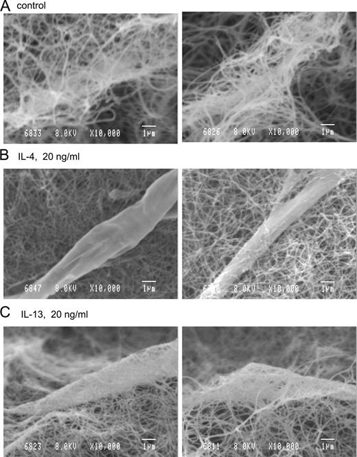 FIGURE 6. Scanning electron microscopic observation of BTSMCs embedded in collagen gels. Control (A), IL-4-treated (B, 20 ng/ml, 6 h), and IL-13-treated (C, 20 ng/ml, 6 h) BTSMCs embedded in collagen gels were observed with a scanning electron microscope (×10,000). Part of the single SM cell and surrounding collagen fibers are shown in each panel. Two different view fields are shown for each condition. Scales, 1 μm.