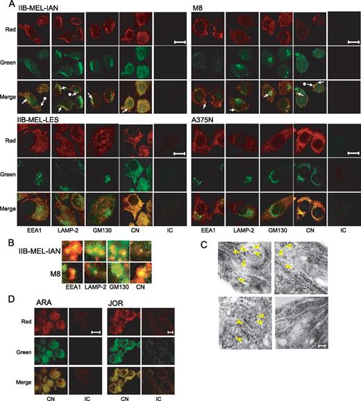 FIGURE 4. Subcellular localization of MICA in human melanoma cells. A, MICA was detected with the mAb D7 and Cy3-labeled secondary Ab (red) in the indicated cell lines. Colocalization markers were detected using FITC-labeled mAbs specific for EEA1 (early endosomes), LAMP-2 (late endosomes/lysosomes), GM130 (Golgi) and calnexin (CN, ER). Analysis was performed by confocal microscopy. White arrows show colocalization (yellow staining) in IIB-MEL-IAN and M8 cells. IC: isotype control mAb. Bar = 10 μm. B, Higher magnification of indicated areas of A. C, Electronic microscopy of IIB-MEL-LES cells stained with the mAb D7 (top and bottom left images) or an IC mAb (bottom right image). Arrowheads, MICA localized in association with ER cisternae. Bar = 100 nm. Results are representative of three independent experiments. D, Colocalization of MICA and CN assessed by confocal microscopy in paraffin-embedded sections of melanoma metastases. Bar = 10 μm.