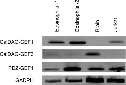 FIGURE 5. Expression of Rap GEFs in resting eosinophils. PCR analysis of GEF and control GAPDH expression in freshly isolated, resting eosinophils from two independent donors was performed using transcript-specific primers. Human brain and Jurkat T cell RNA was used as positive controls for GEF expression.