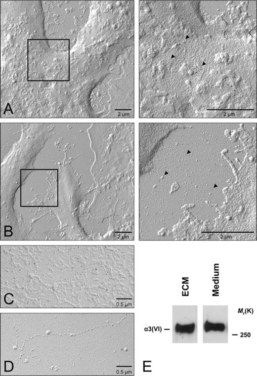 FIGURE 5. T6C secreted by THP-1 macrophages is not assembled into filaments in the ECM. A, Surface replicas of macrophages viewed by electron microscopy. Gold-labeled T6C is bound in clusters to the cell surface (enlargement of the boxed area is at right). B, Scanty labeling of T6C on the culture vessel surface beside the cells (enlargement of the boxed area is at right). C, Rotary shadowing of matrix underlying macrophages removed by aspiration. D, Macrophages do not assemble beaded filaments of T6C as other matrix-producing cells such as fibroblasts do. E, Extracts of ECM remaining after removal of macrophages. Extracts contain intact α3(VI) chains, indicating that at least this chain of T6C is present in the matrix underlying THP-1 macrophages. T6C in the medium of the same culture was a control. Arrowheads in A and B mark T6C labeling.
