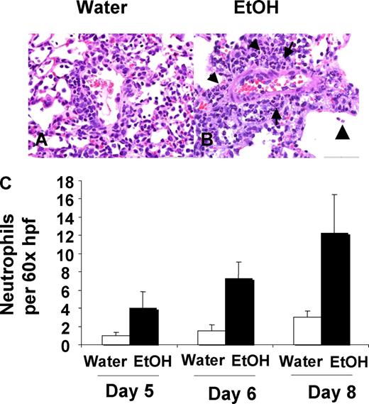 FIGURE 7. Chronic alcohol consumption increases neutrophil recruitment to the lungs. Lung, representative samples from 8-wk water-(A) and EtOH-(B) conditioned C57BL/6 mice 8 days post influenza inoculation. Morphologically, the EtOH mice exhibited increased neutrophil (arrow) infiltration especially noted in a perivascular orientation with extension into alveolar air spaces (arrowhead) vs the typical mononuclear infiltration seen in water controls. C, Quantification of neutrophils per high power field. Random foci in the lung were counted (60× high power field × 5), and the average neutrophils per high power field tallied and the means for each group normalized to day 5 water with a value of “1.” Water vs EtOH groups had significant differences in neutrophil infiltration (p < 0.01, treatment effect, two-way ANOVA) with significant posttest differences at day 8 (p < 0.05). The eight sections including four depths per lung were scored independently from three mice per group.