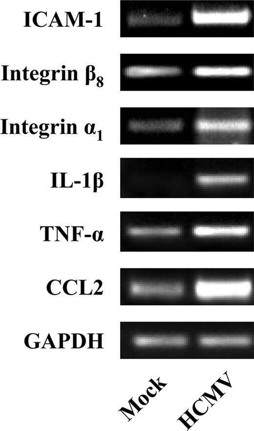 FIGURE 2. Confirmation of selected chemokine and adhesion molecule gene expression by RT-PCR. Monocytes were mock infected or HCMV infected nonadherently for 4 h at 37°C and RNA was harvested. RT-PCR analysis confirmed that HCMV induced the expression of ICAM-1, integrin β8, integrin α1, IL-1β, TNF-α, and CCL2. GAPDH expression is shown as a control.