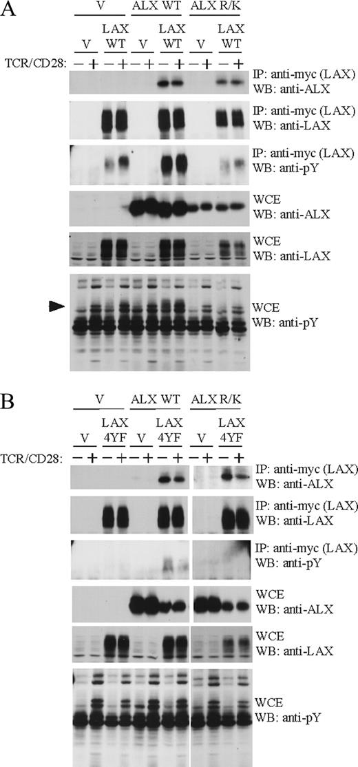 FIGURE 1. The association of ALX with LAX occurs independently of phosphotyrosine recognition. Jurkat cells were cotransfected with expression plasmids for either WT ALX or an ALX SH2 domain mutant incapable of phosphotyrosine binding (ALX R/K) along with either (A) WT LAX or (B) a LAX mutant (LAX 4YF) in which the four sites of tyrosine phosphorylation were replaced. Empty vector (V) was used to standardize total plasmid transfected between samples. The cells were left unstimulated (−) or stimulated for 2 min (+) with Abs to TCR and CD28. WCE were made and subject to immunoprecipitation (IP) with Abs to a myc-epitope present on LAX. Western blotting (WB) was then performed with the indicated Abs to analyze expression of LAX and ALX in the WCEs and immunoprecipitations. Note that LAX appears as a “smear” on immunoblots, which is likely an effect of glycosylation, as is often found in transmembrane proteins. The minor, lower m.w. bands observed in LAX immunoblots are likely incompletely modified forms of the protein. Anti-phosphotyrosine blotting with 4G10 confirmed TCR/CD28 stimulation, as well as LAX phosphorylation. The arrowhead indicates the position of a tyrosine-phosphorylated band present in unstimulated cells only upon transfection with both WT ALX and LAX. This band is likely LAX, based on m.w., and consistent with the substantial increase in phosphorylated LAX in the immunoprecipitates observed upon cotransfection with ALX.