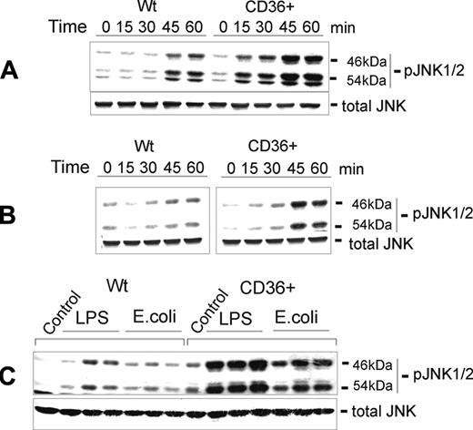 FIGURE 9. Time- and dose-dependent LPS- and E. coli-induced JNK1/2 activation in CD36-overexpressing and mock-transfected HEK293 cells. Following an overnight incubation in serum-free medium, the cells were stimulated with 100 ng/ml of LPS (A) or 1 ng/ml of E. coli K12 (B) for varying intervals, or, alternatively, the cells were stimulated with 10, 100, or 1000 ng/ml of LPS or 1, 5, or 10 ng/ml of E. coli K12 for 45 min (C). Phosphorylated forms of JNK1/2 were detected by Western blotting using specific anti-JNK1/2 (pThr183/pTyr185) Abs. The nonphosphorylated form of JNK was assayed simultaneously in the same samples.