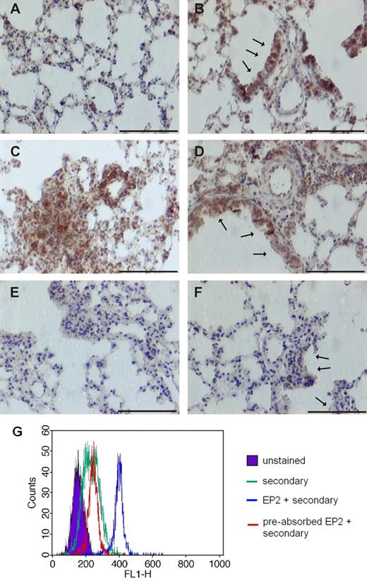 FIGURE 9. Infiltrating inflammatory cells in a mouse model of allergen-challenged lungs and human eosinophils express EP2 receptors. A–F, As determined by immunohistochemistry, EP2 receptors (stained brown) were detected in sparse inflammatory cells and bronchial epithelial cells (indicated by arrows) in lung sections from control mice (A and B). The dense infiltrates of inflammatory cells in allergen-challenged lungs were also EP2 positive (C). Epithelial cells (arrows) from allergen-challenged mice can be seen in D. Preabsorption of the Ab resulted in the loss of specific staining in allergen-challenged lungs (E and F). The photomicrographs show typical examples of each group (n = 3). Scale bars are 100 μm. G, Histogram of indirect flow cytometric staining of isolated human eosinophils with rabbit polyclonal EP2 Ab and preabsorbed EP2 Ab followed by anti-rabbit secondary Ab conjugated with Alexa Fluor 488. Unstained eosinophils and cells incubated with secondary Ab alone are also shown for comparison. The histogram shows one representative staining of four with different donors.