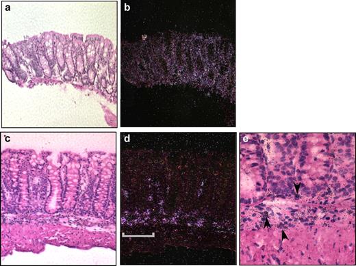 FIGURE 5. DSS exposure induced mononuclear cell-derived eotaxin-1 mRNA expression. Colonic sections were subjected to in situ hybridization using an eotaxin-1 antisense probe. The hybridization signal of the eotaxin-1 probe is shown in a representative colon from control-treated (a and b) and DSS-treated (c and e) mice. Brightfield (a, c, and e) and darkfield (b and d) images original magnifications of ×100 (a–d) and ×1000; scale bar = 50 μm (e). Arrows indicate eotaxin-1 expression in mononuclear cells (signal grains appear bright in darkfield images and dark in brightfield images).
