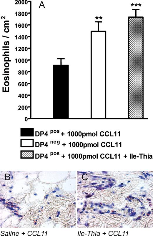 FIGURE 3. Recruitment of eosinophils into the skin following intradermal injection of CCL11 depends on DPPIV. CCL11 was intradermally injected at a dose of 1000 pmol either in combination with saline or the DPPIV inhibitor Ile-thia in DPPIVpos vs DPPIVneg rats and eosinophil recruitment quantified in samples collected 4 h later (A). Data represent means ± SEM and significant differences in comparison with DPPIVpos rats receiving CCL11 are indicated by asterisks (**, p < 0.01; ***, p < 0.001) (n = 5–6/group). B and C provide representative May-Grünwald/Giemsa-stained sections of rat skin. Eosinophils are primarily located close to small vessels.