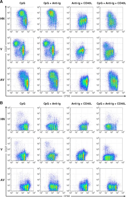 FIGURE 6. Proliferation and differentiation of CD27+ B cells in the presence of CpG-B. Representative flow cytometric dot plots of CFSE-labeled (A) CD27+ B cells from a HIV-negative (HN), a HIV-viremic (V), and a HIV-aviremic (AV) individual and naive B cells (B) from a HIV-negative (HN), a HIV-viremic (V), and a HIV-aviremic (AV) individual stimulated with CpG-B alone (CpG), CpG-B plus anti-Ig, anti-Ig plus CD40L, or a combination of CpG-B, anti-Ig, and CD40L.