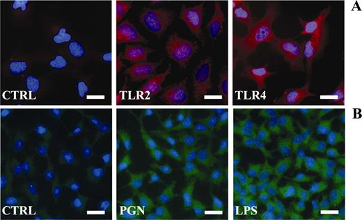 FIGURE 1. TLR and DEFB2 expression in human keratinocytes. A, Cells were analyzed by immunofluorescence analysis for TLR2 and TLR4 expression (CTRL, negative control by omission of primary antibody). B, Following treatment with PGN or LPS, cells were analyzed for their DEFB2 expression in comparison with untreated cells (CTRL). Bars, 10 μm.