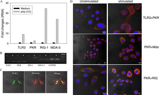 FIGURE 2. Human keratinocytes express the whole panel of dsRNA sensing molecules. Baseline and poly(I:C)-inducible expression of the dsRNA sensing molecules TLR3, PKR, RIG-I, and MDA5 in cultured normal human keratinocytes. A, Gene expression level of TLR3, PKR, RIG-I, and MDA5 in human keratinocytes after stimulation with 20 μg/ml poly(I:C) for 36 h or without stimulation (medium control) evaluated by quantitative real-time PCR (qPCR). qPCR was performed in duplicates with five replicate samples. B, Gel electrophoresis of qPCR products from A. qPCR products of TLR3, PKR, RIG-I, and MDA5 were loaded on a 2% agarose gel. + indicates qPCR products after poly(I:C) stimulation; −, unstimulated medium controls. The intensity of amplicon bands is compared with GAPDH. C, Intracellular colocalization of TLR3 (green fluorescence) and Alexa 594-labeled dextrane (red fluorescence). Cultured human primary keratinocytes were first loaded with dextrane for 1 h, which was followed by stimulation with poly(I:C) (20 μg/ml). D, Immunofluorescence costaining with specific Abs against TLR3, RIG-I, MDA5, and PKR demonstrates poly(I:C)-inducible intracellular expression of all four receptors in human keratinocytes. Keratinocytes were cultivated to 70% confluency on glass chamber slides. After incubation with poly(I:C) or without (unstimulated, medium control), cells were fixed, permeabilized, and then costained with Abs against TLR3, RIG-I, and MDA5, respectively (green fluorescence), and PKR (red fluorescence). Immunostaining was followed by nuclear staining with TOPRO3 (10 mM) for 20 min. Samples were analyzed under a confocal microscope.