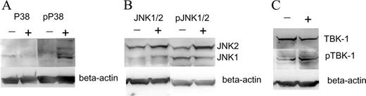 FIGURE 3. Stimulation of cultured human keratinocytes with the dsRNA analog poly(I:C) induces protein phosphorylation in both the NF-κB and the IRF3 pathway. The following kinases were analyzed: p38, JNK, and TBK-1. Human keratinocytes were incubated with 20 μg/ml poly(I:C) for 1 h. The phosphorylation of (A) p38, (B) JNK1/2, and (C) TBK-1 was confirmed by immunoblotting using Abs specific for (A) p38 and pp38, (B) JNK1/2 and pJNK1/2, and (C) TBK-1 and pTBK-1. + indicates Western blots after poly(I:C) stimulation; −, unstimulated medium controls.