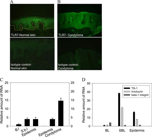 FIGURE 6. TLR7 expression in normal and in human papillomavirus-infected human epidermis. A and B, Expression pattern of TLR7 in healthy human skin and in condyloma-derived human papillomavirus-infected skin tissue. TLR7 immunostaining was performed on cryopreserved tissue sections. The dotted line indicates the basement membrane zone at the dermo-epidermal junction. C, Whole-cell populations isolated from healthy epidermis were divided into basal (BL) and suprabasal (SBL) layer cells. The gene expression of TLR7 was evaluated using quantitative real-time PCR (qPCR). For comparison, samples from whole epidermis and from condyloma biopsies were also analyzed. D, To demonstrate the quality and efficiency of the fractionated cell isolation used in C, the expression of involucrin and transglutaminase-1 as epidermal differentiation markers, and of β1-integrin as marker for basal layer cells, was analyzed in qPCR either for whole epidermis or for BL and SBL layer cells.