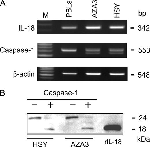 FIGURE 4. Expression of IL-18 in human salivary gland cells in culture. A, Total RNA was extracted from human salivary gland AZA3 and HSY cells. Human PBLs were used as a positive control. The m.w. marker (M) is also shown. cDNA was prepared and analyzed for the expression of IL-18, caspase-1, and β-actin mRNA by RT-PCR. B, Cell lysates of HSY and AZA3 were either untreated or treated with caspase-1 (20 U/ml) for 1 h, and the treated samples were subjected to Western blotting with anti-IL-18 mAb 25-2G. IL-18 (10 ng) was loaded as a positive control.