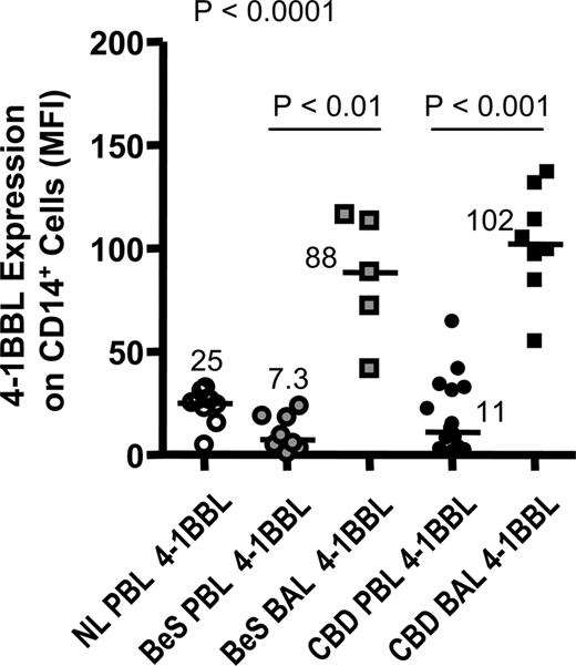 FIGURE 5. 4-1BB ligand expression is elevated on CD14+ cells in the lung of BeS and CBD patients. 4-1BBL expression was evaluated on CD14+ cells from the peripheral blood of normal (n = 11), BeS (n = 8), and CBD (n = 16) patients and the BAL of BeS (n = 5) and CBD (n = 16) subjects. Median values are shown with solid lines. Statistical significance was established using the Kruskal-Wallis test.