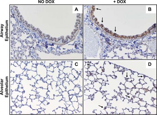 FIGURE 1. Conditional transgenic expression of the NKG2D ligand Raet1a in the lungs of mice. Immunohistochemical analysis of RAET1 was performed using sections of paraffin-embedded lungs from naive Raet1a-tg mice treated with or without DOX. Photomicrographs are of large airways of mice not administered DOX (A) or administered DOX (B), as well as the lung parenchyma of mice not administered DOX (C) or administered DOX (D). Photomicrographs are representative of five mice/group (original magnification ×200).