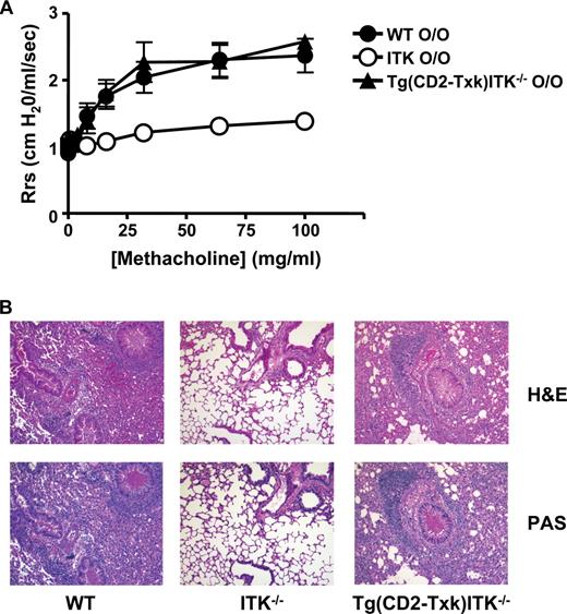 FIGURE 2. Rescue of AHR in Itk-null mice by expression of the related kinase Txk. A, WT, Itk-null, or Tg(CD2-Txk)Itk−/− mice were immunized and challenged intranasally with OVA, followed by analysis of AHR by mechanical ventilation. Filled circles, WT; open circles, Itk−/−; filled triangles, Tg(CD2-Txk)Itk−/− mice. O/O indicates mice that have been immunized with OVA and then challenged intranasally with OVA. Differences are statistically significant between WT and Itk−/− or Tg(CD2-Txk)Itk−/− and Itk−/− mice (p < 0.05) but not significant between WT and Tg(CD2-Txk)Itk−/− mice (n = 5–7 mice per group, representative of three experiments). B, Mice were immunized and challenged intranasally with OVA, followed by analysis of lung sections by H&E (top panels) or periodic acid-Schiff (PAS) staining (bottom panels); representative experiment of three is shown.