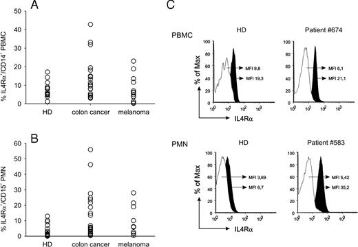 FIGURE 2. Expansion of IL4Rα expressing cells in monocytes and granulocytes. PBMC (A) and PMN (B) from healthy donors, colon cancer or melanoma patients were purified as described in Materials and Methods and labeled with CD14, CD15, and IL4Rα or isotype control. To calculate the percentage of IL4Rα among monocytes, cells were gated in the monocyte-gated region and positive cells were considered the IL4Rα+/CD14+ cells after subtraction of the background measured with the isotype control of IL4Rα. To obtain the percentage of IL4Rα among granulocytes, cells were gated in the granulocyte-gated region and IL4Rα+/CD15+ cells were calculated after subtraction of the background. C, Representative example of PBMC and PMN from an healthy donor (HD), melanoma patient 674 and melanoma patient 583 labeled with CD14, CD15, and IL4Rα and analyzed by cytometry as described. MFI, mean fluorescence intensity.