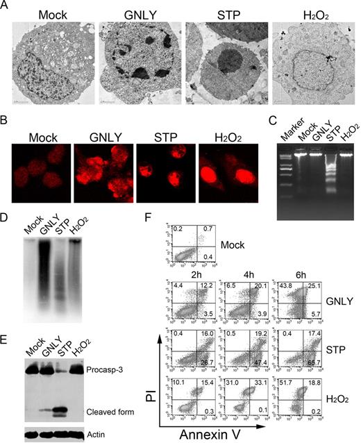FIGURE 2. GNLY induces necroptosis with ssDNA nicks. A and B, HeLa cells were incubated with 50 μM GNLY or 10 μg/ml STP or 20 mM H2O2 at 37°C for 6 h and detected by a high-magnification transmission electron microscopy (X1700) (A) or stained by PI and followed by confocal microscopy (B). C, GNLY does not cause dsDNA fragmentation. Jurkat cells were treated with 50 μM GNLY or 10 μg/ml STP or 20 mM H2O2 at 37°C for 6 h. Genomic DNA was extracted and visualized by 2% agarose gel electrophoresis with ethidium bromide staining. D, GNLY triggers ssDNA nicks. The nuclei of the above treated Jurkat cells were extracted and radiolabeled through Klenow DNA polymerase. The DNA nicks were detected by denaturing alkaline gel electrophoresis. E, Caspase 3 was less processed by GNLY. Jurkat cells (2 × 105) were treated as above and probed with anti-caspase 3 serum. β-Actin was unchanged as a loading control. F, Jurkat cells (2 × 105) cells were incubated with 50 μM GNLY or 10 μg/ml STP or 20 mM H2O2 at 37°C for the indicated times and stained by annexin V and PI. Data are representative at least three separate experiments.