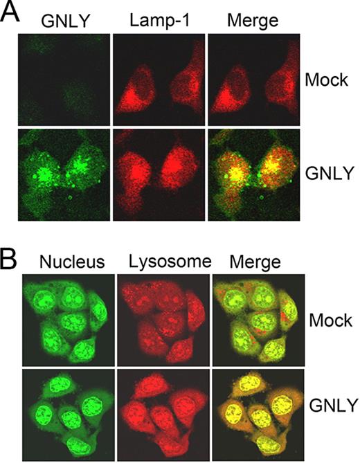 FIGURE 3. GNLY induces lysosomal membrane permeabilization. A, GNLY can target lysosomes of target cells. HeLa cells were treated with 50 μM GNLY for 6 h and probed with anti-GNLY mAb and anti-LAMP-1 rabbit Ab, followed by staining with the second Alex Fluor 488-conjugated donkey anti-mouse Ab and Alex Fluor 594-conjugated donkey anti-rabbit Ab. GNLY staining green fluorescence is shown on the left, LAMP-1 staining red in the middle, and the merged image on the right. B, GNLY can trigger release of lysosomal contents into the cytosol. HeLa cells were incubated with AO and treated with 50 μM GNLY for 6 h. AO shows green (nucleus and cytosol; left) and red (lysosome; middle). The merged image is on the right.