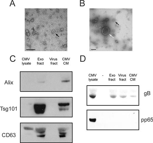 FIGURE 6. Exosome fractions from CMV-infected HUVEC-conditioned medium contain CMV gB but not pp65. A, Transmission electron micrograph of an exosome fraction from CMV-infected HUVEC-conditioned medium. The arrow indicates an example of an exosome-like structure (bar, 100 nm). B, Transmission electron micrograph of a virus fraction. This image was selected to show the presence of exosomes (example indicated by black arrow) within the virus fraction and to demonstrate the morphological differences between exosomes and CMV particles (indicated by white arrow). Similar observations were made in two additional fractionations (bar, 100 nm). C, Immunoblots determining the presence of exosome markers Alix, Tsg101, and CD63 in fractions content of: CMV-infected HUVEC sonicate (lane 1), exosome fraction (lane 2), virus fraction (lane 3); and unfractionated CMV-infected HUVEC-conditioned medium (lane 4). D, Immunoblots assessing CMV gB and pp65 content of 1.0 μl of CMV-infected HUVEC sonicate (lane 1), 6.5 μl of medium alone (lane 2), 6.5 μl of exosome fraction (lane 3), 6.5 μl of virus fraction (lane 4); and 6.5 μl of unfractionated CMV-infected HUVEC-conditioned medium (lane 5). Lanes 3–5 were derived from the same CMV-infected EC-conditioned medium. Data are representative of four experiments with similar results.