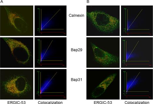 FIGURE 2. Colcalization images of ERGIC-53, a marker of the ERGIC with calnexin (an ER marker), Bap29, and Bap31. A, 37°C. All proteins were labeled with primary Abs of different species or isotypes, followed by specific fluorescent anti-Ig. See Materials and Methods for details. Left panels, Show the overlays of images of ERGIC-53 in red and the other proteins in green. Right panels, Scatter plots of the pixels above a threshold that are both red and green. For ideal colocalization, pixels are distributed along a diagonal. The spread away from, but parallel to, the diagonal is characterized by Pearson’s coefficient. Pixels off the diagonal are due to bleed-through of one color into the other channel. It can be seen that there is excellent colocalization of ERGIC-53 and Bap31 (lower panels), and good colocalization of ERGIC-53 with calnexin and Bap29. B, Colocalization after cells were incubated at 15°C to block recycling of ERGIC to the ER. There is still a significant fraction of Bap31 colocalized with ERGIC-53, indicated by the number of points distributed around the diagonal. There is little colocalization of calnexin or Bap29.