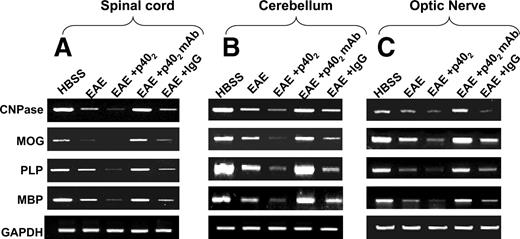 FIGURE 10. Effect of p402 and p402 mAb on the expression of myelin-specific genes in the spinal cord, cerebellum, and optic nerve of EAE mice. Spinal cord (A), cerebellum (B), and optic nerve (C) of HBSS-treated normal, EAE (15 dpt), p402-treated EAE (15 dpt receiving p402 from 8 dpt), p402 mAb-treated EAE (15 dpt receiving p402 mAb from 8 dpt), and control IgG-treated EAE (15 dpt receiving control IgG from 8 dpt) mice were analyzed for mRNA expression of MBP, MOG, PLP, and CNPase by semiquantitative RT-PCR. Four mice were used in each group. Results represent three independent experiments.